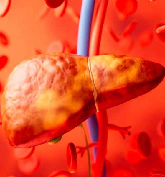 Esteatose hepática e canabinóides