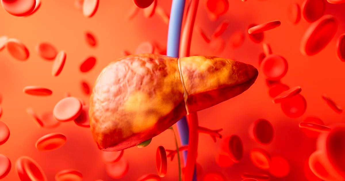 Esteatose hepática e canabinóides