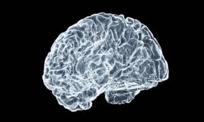 CBN e Alzheimer